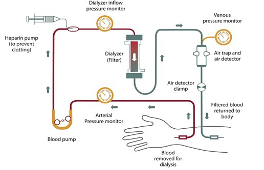 Hemodialysis Service